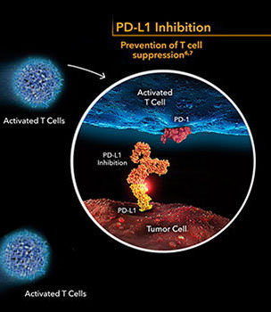 PD-L1 inhibition therapy