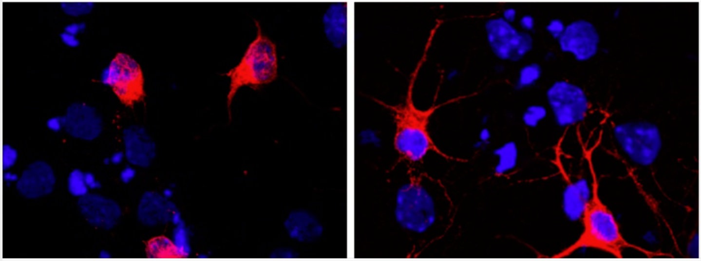 The antibody A13